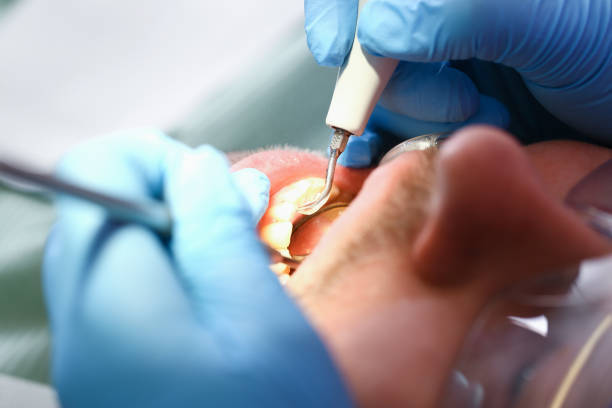 Best Emergency Treatment for Toothache in Purvis, MS