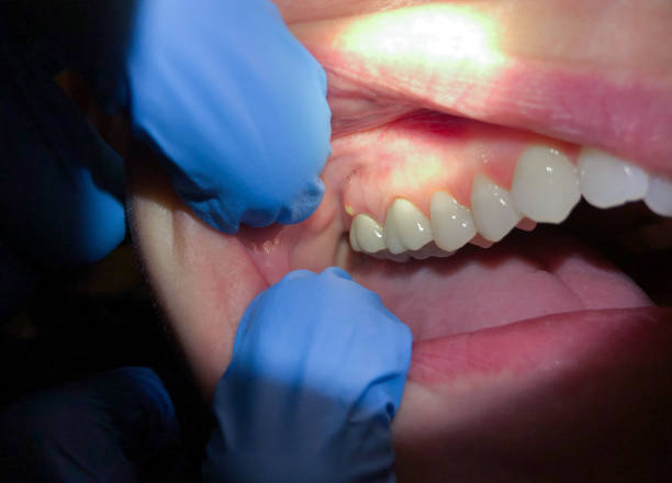 Best Emergency Dental Care for Trauma or Injury in Purvis, MS