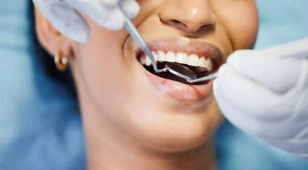 Best After-Hours Emergency Dentist in Purvis, MS